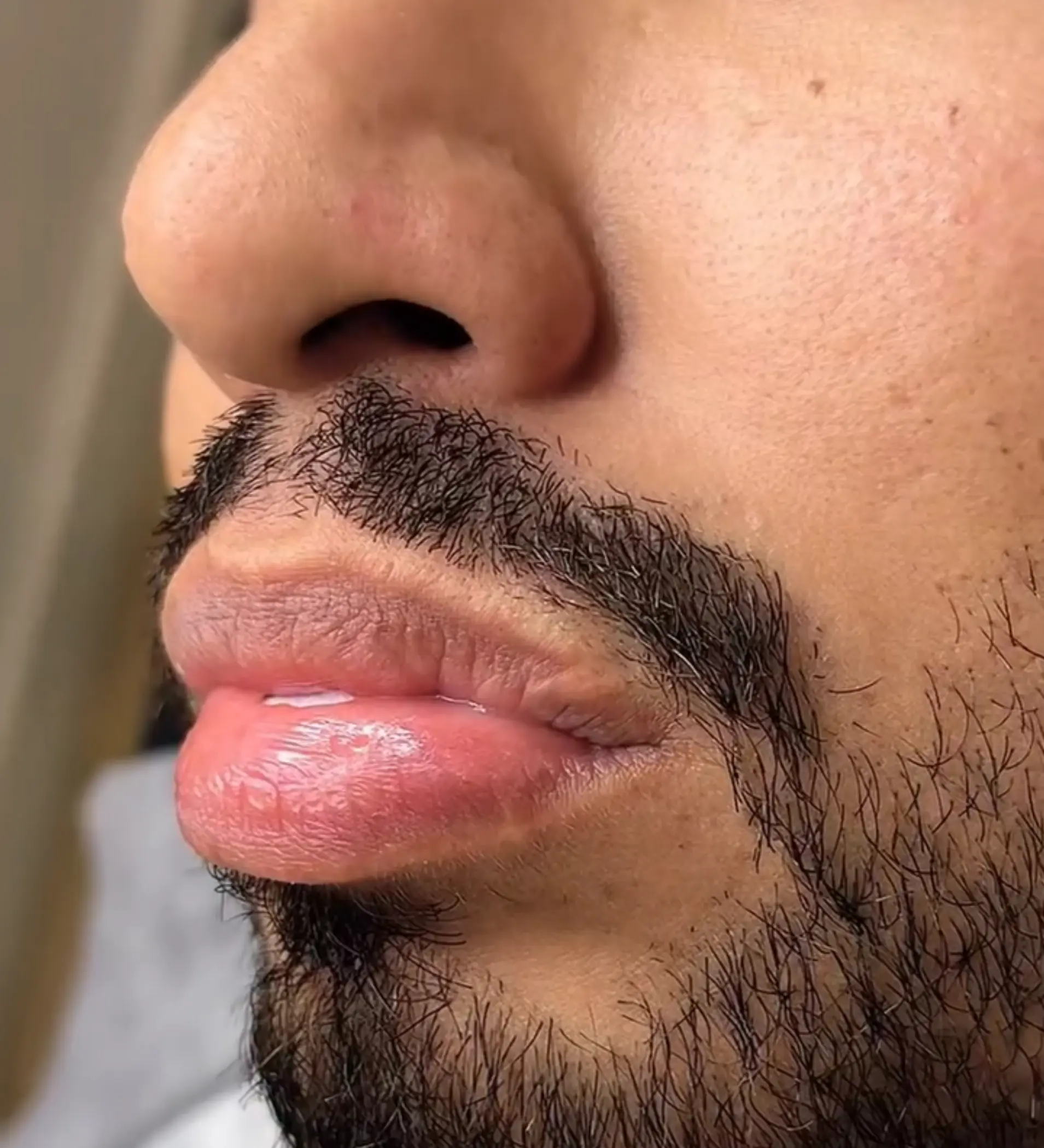 before and after lip tattoo healing
