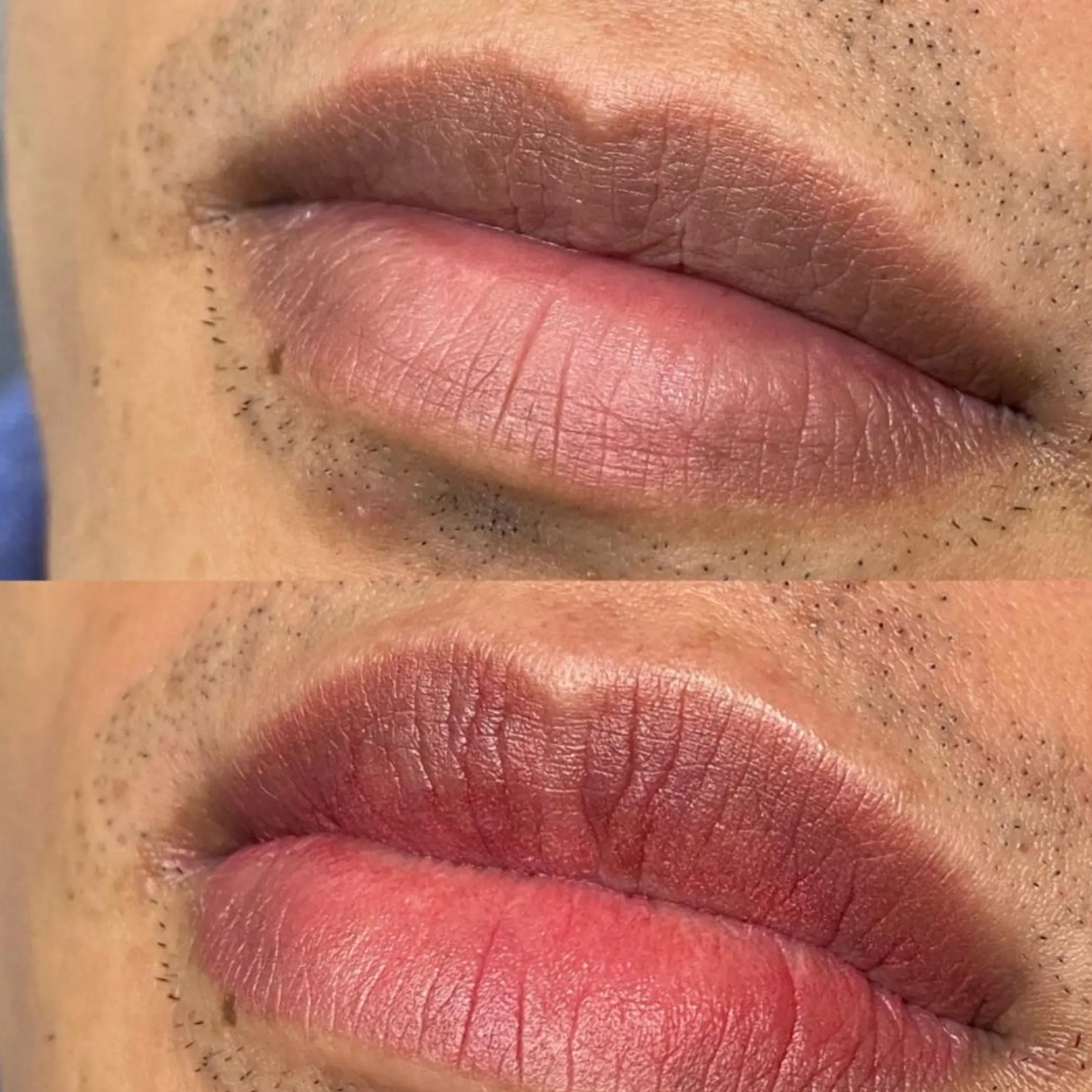 before and after male lip blush australia