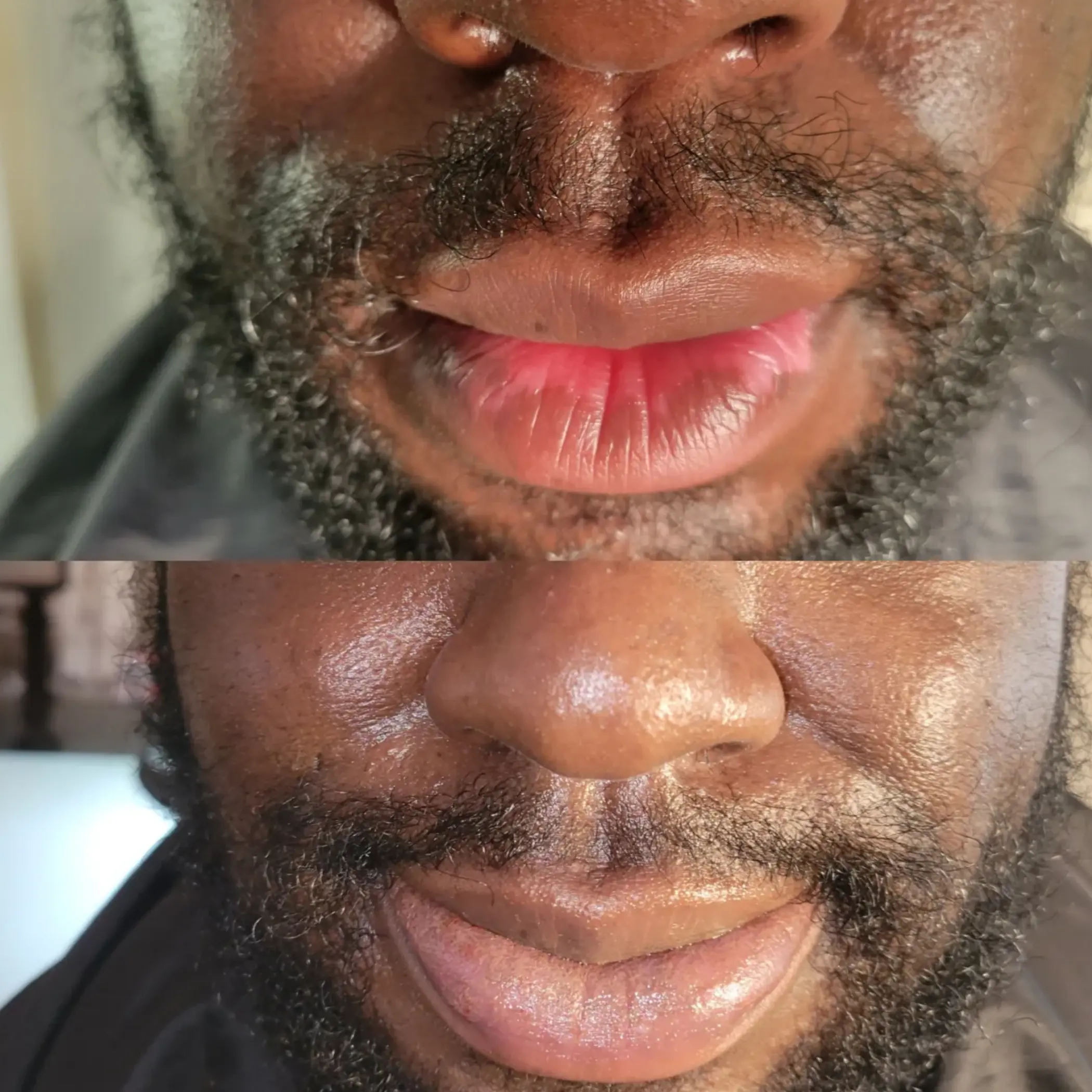 before and after scalp micropigmentation men