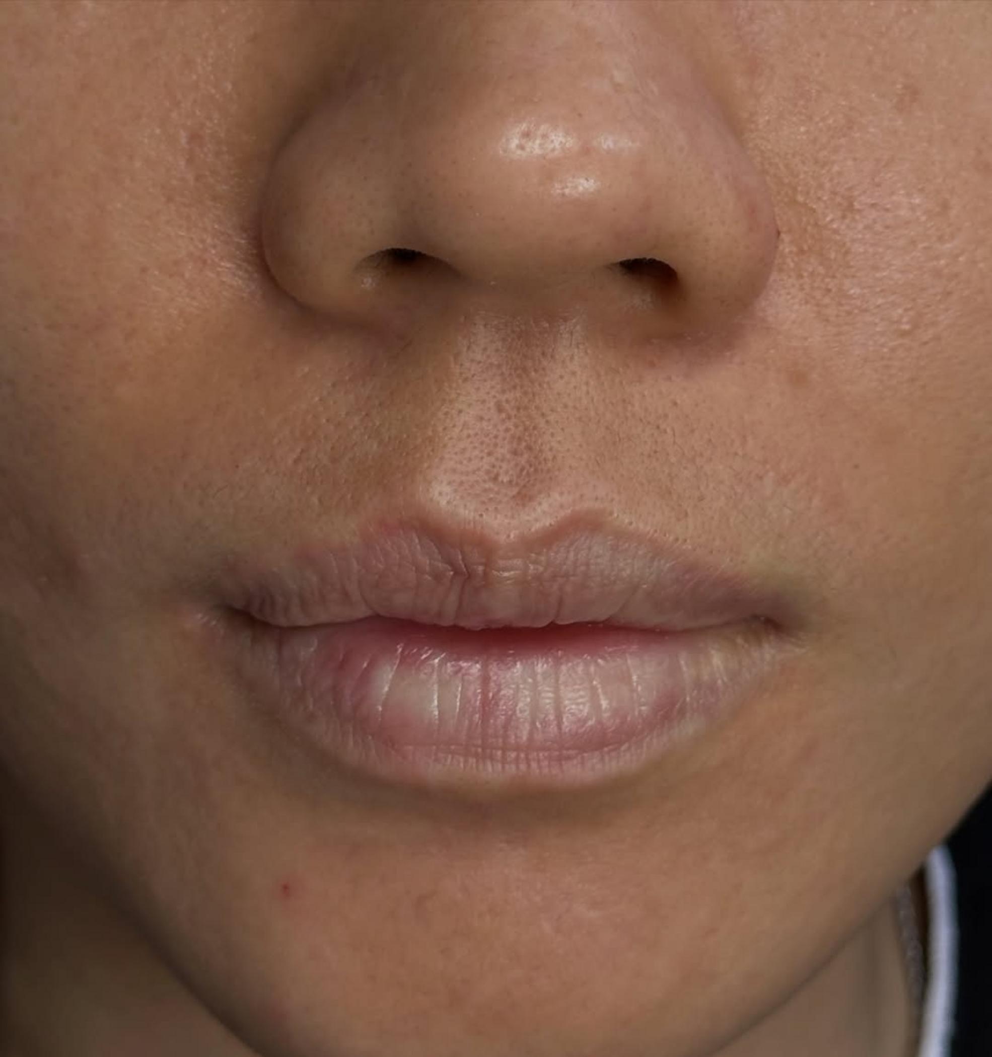 close up lip pigment details healing