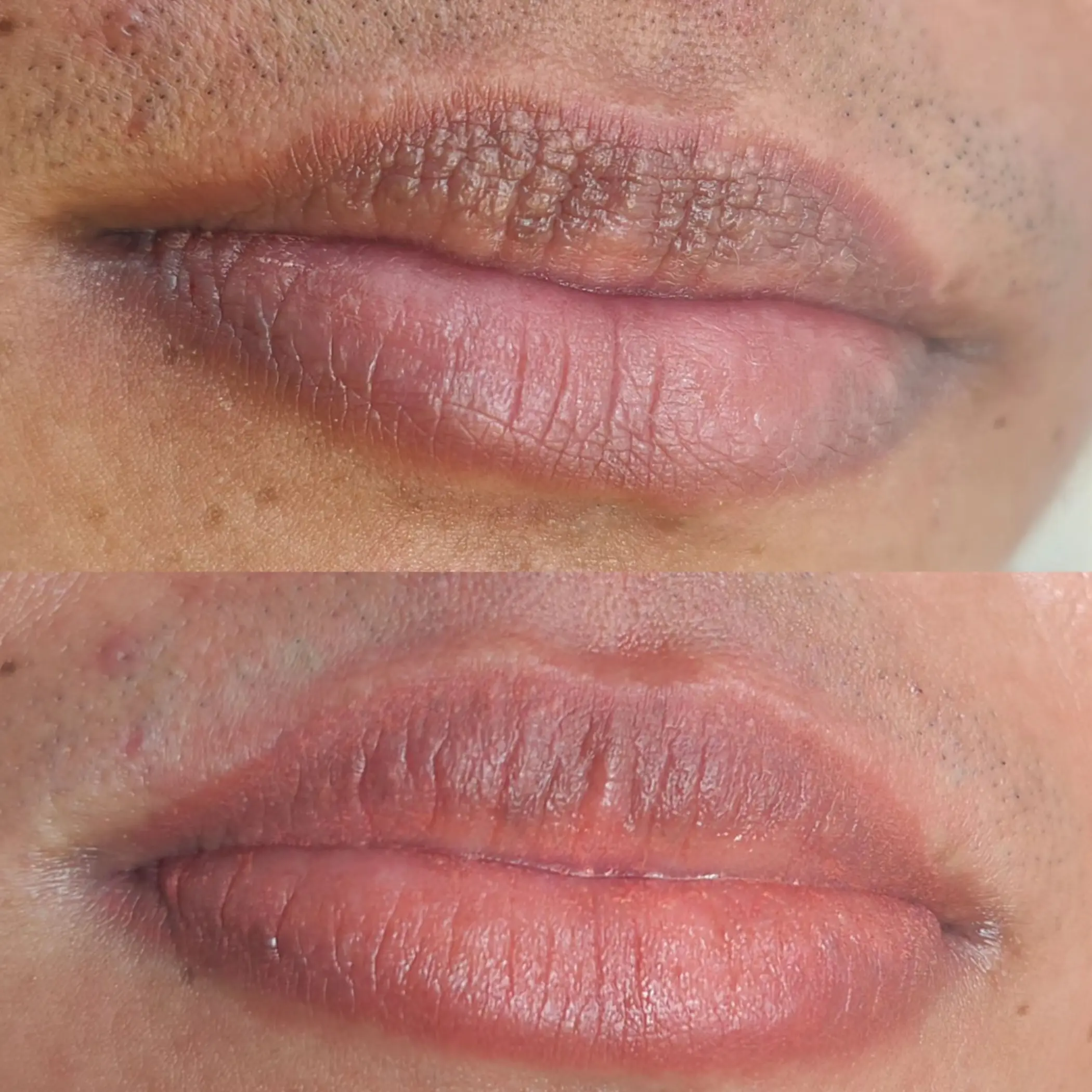 close up lip scar camouflage detail