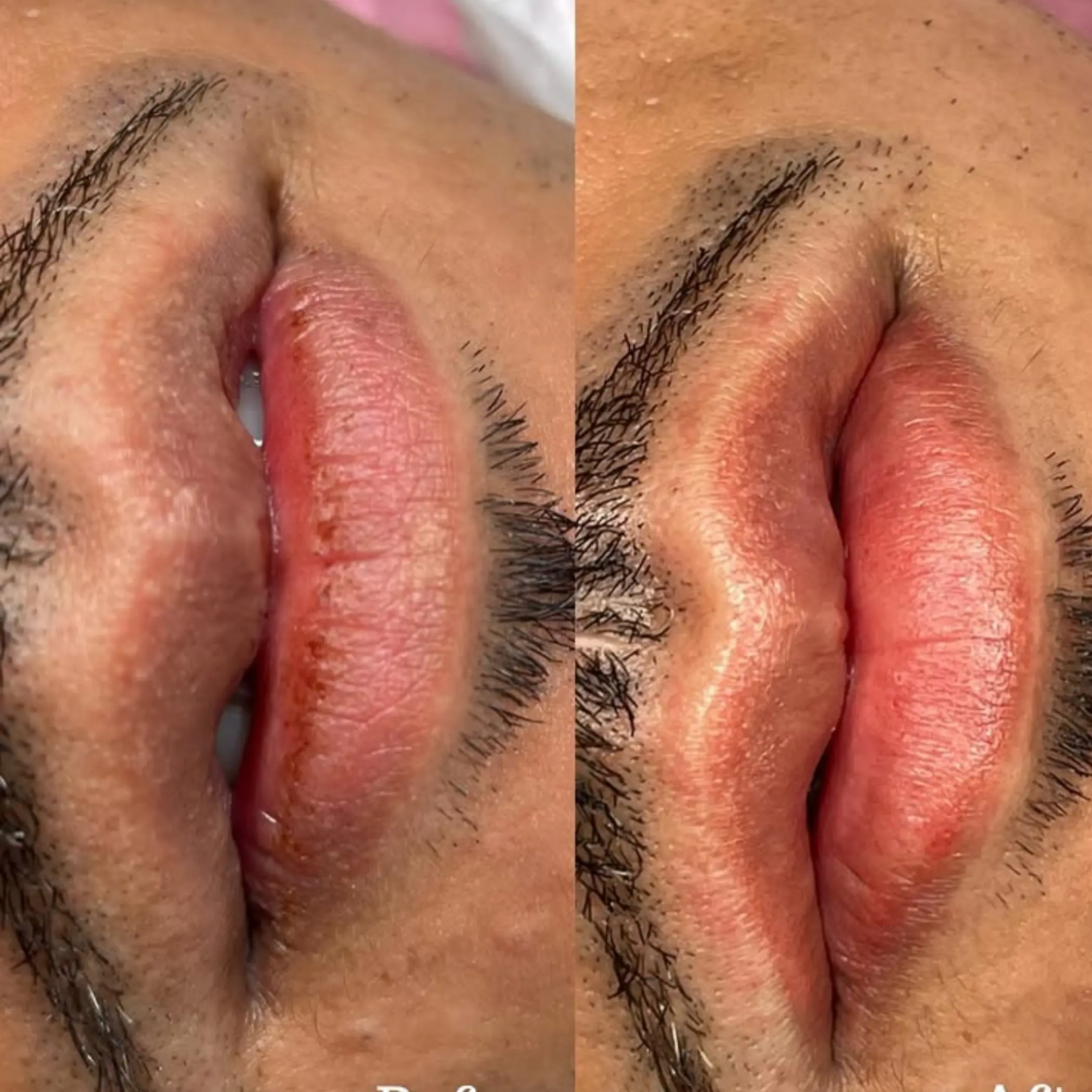 close up scalp pigment dots detail