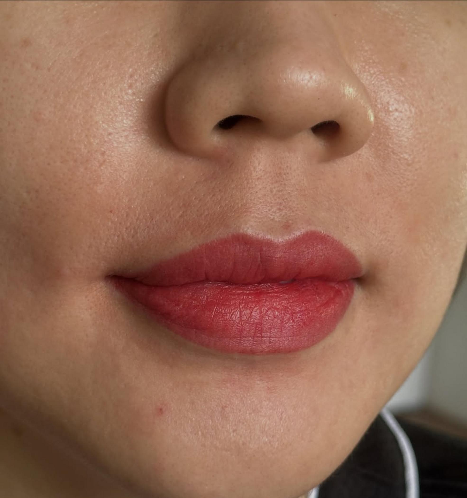 dark lip correction before and after