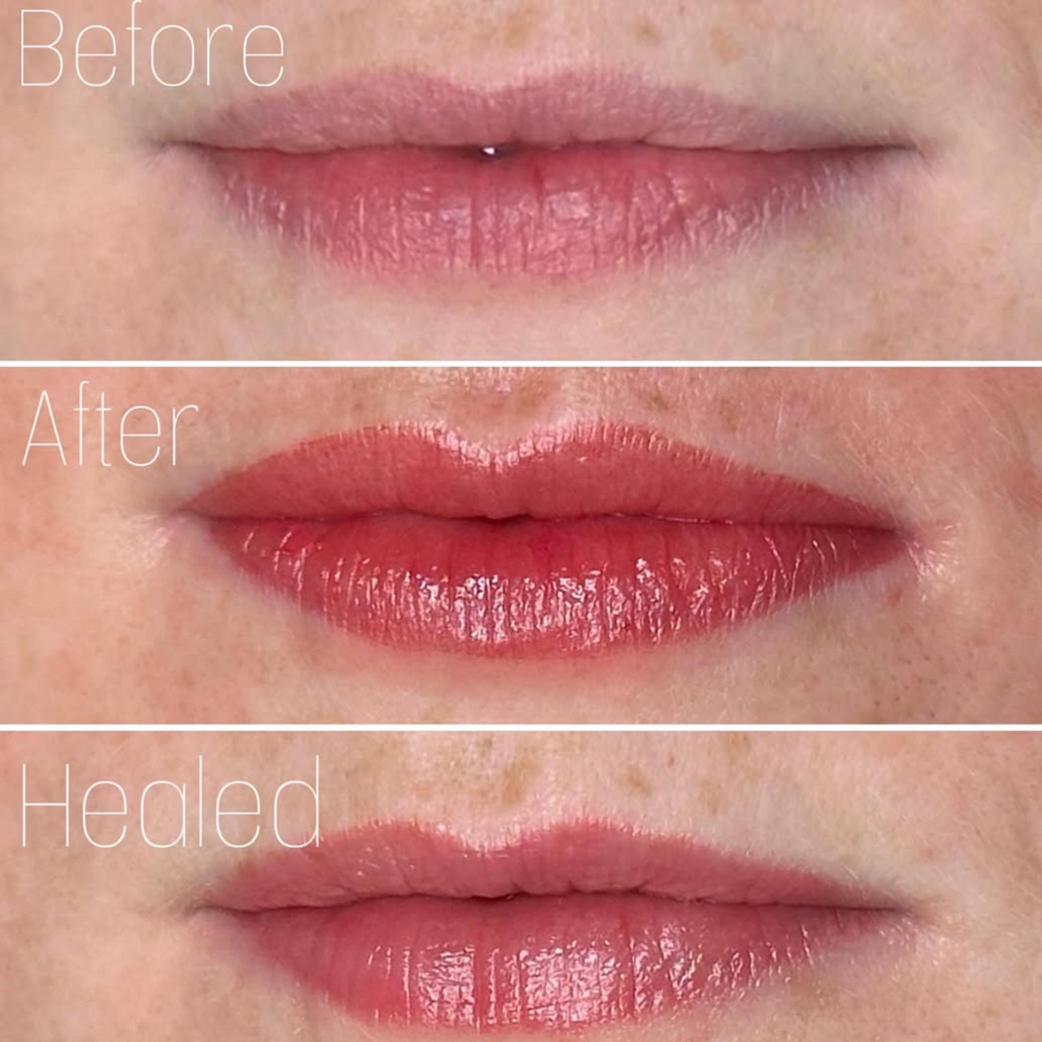 lip micropigmentation procedure step by step