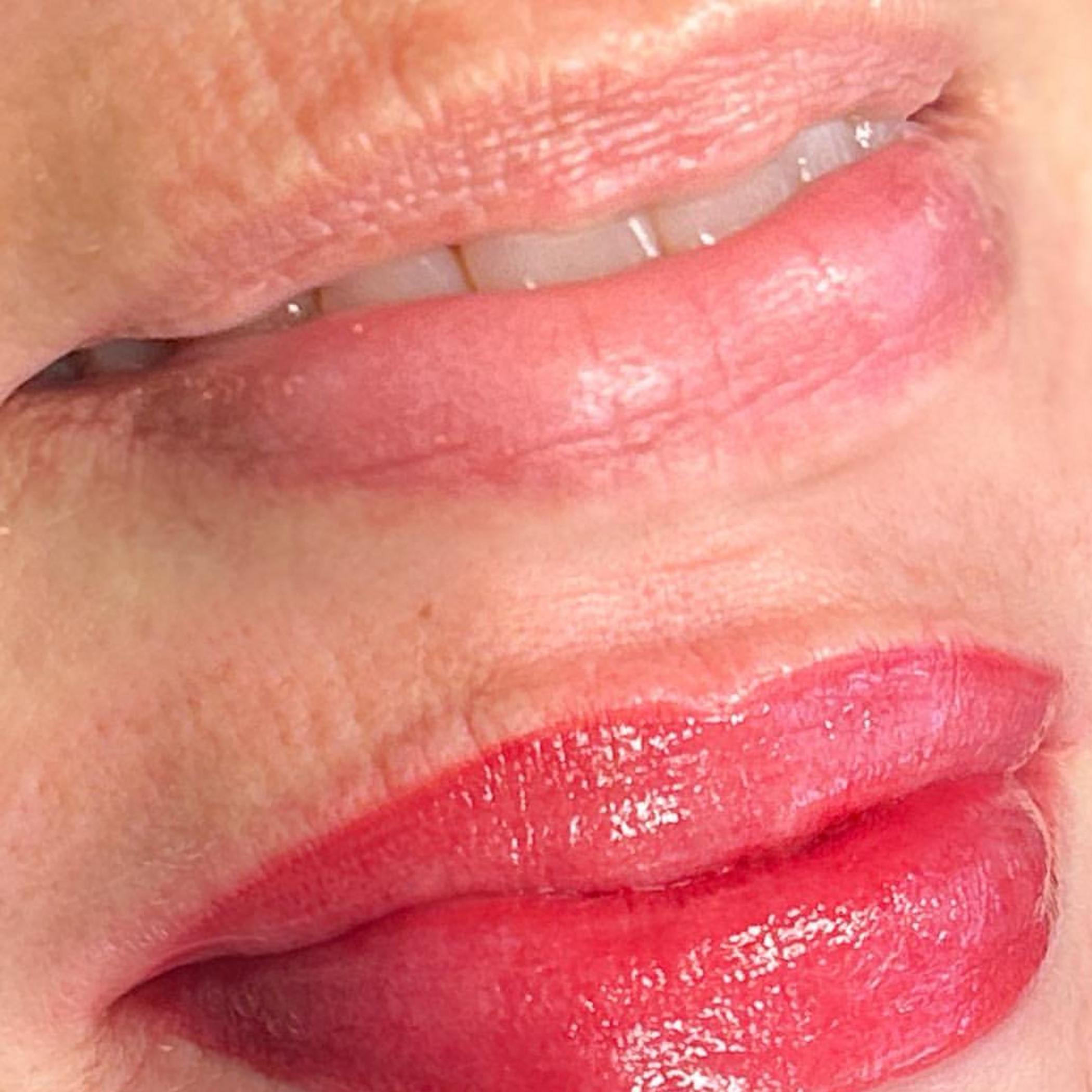 lip tattoo procedure in progress