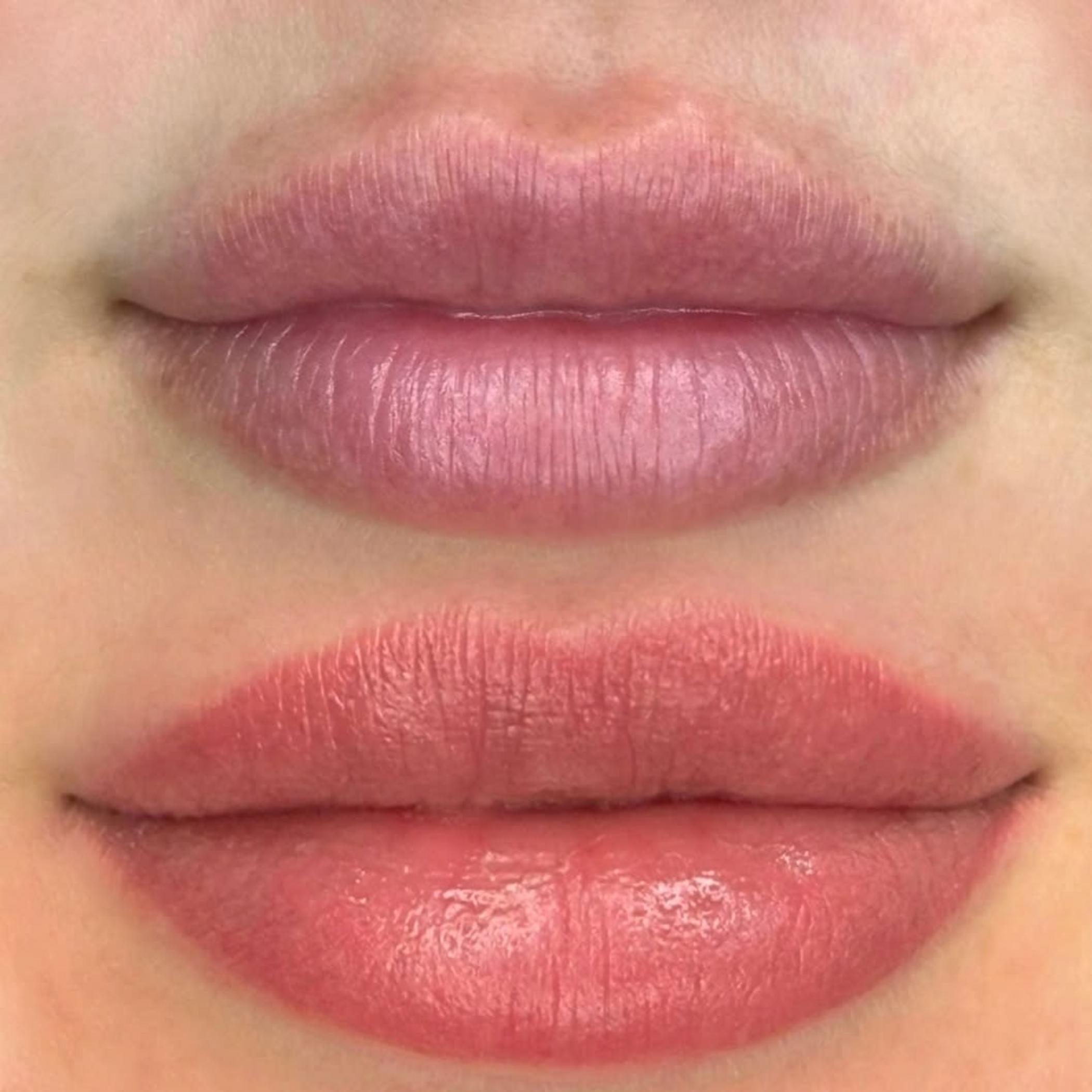 lip tattoo procedure male client beach setup