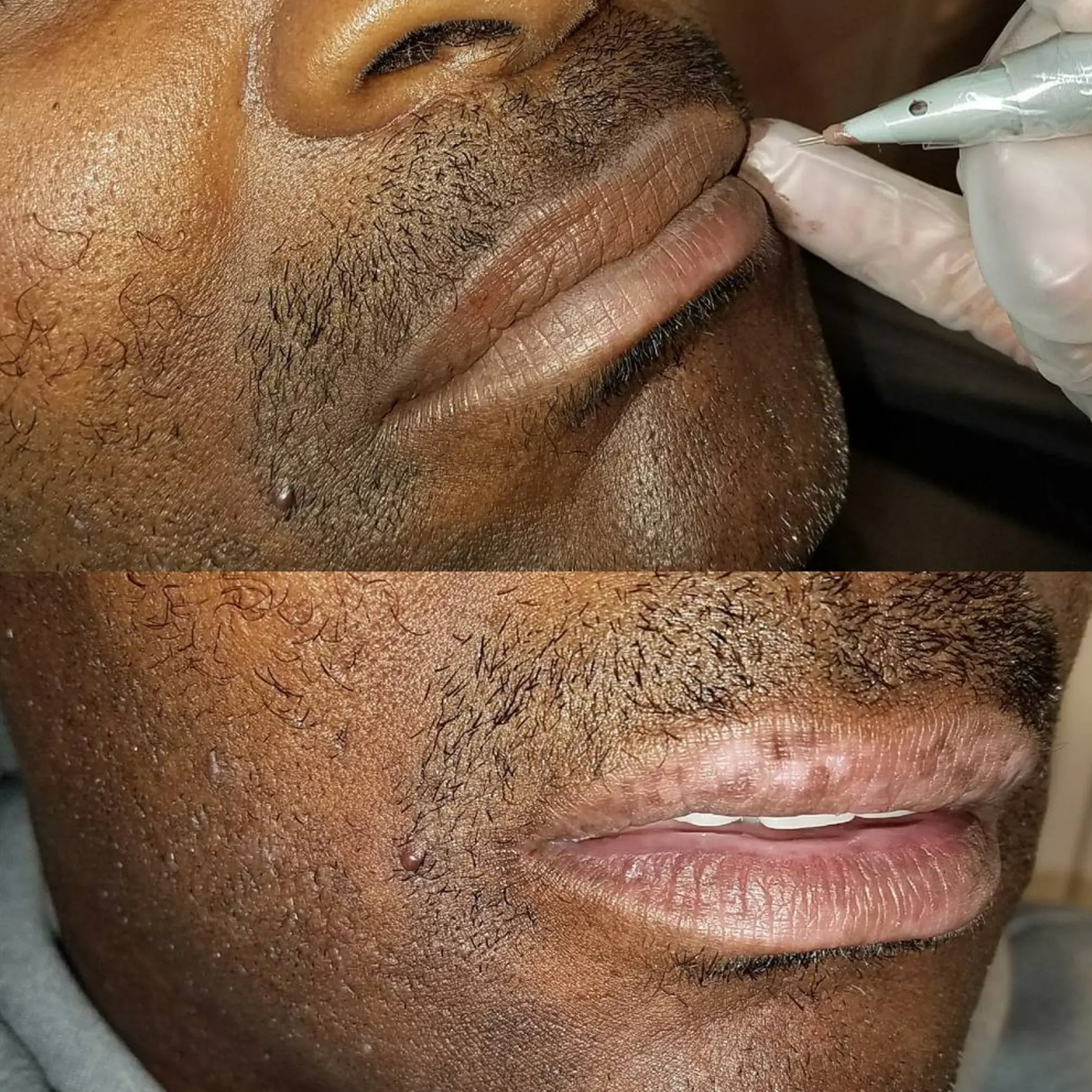 lip tattoo procedure step by step