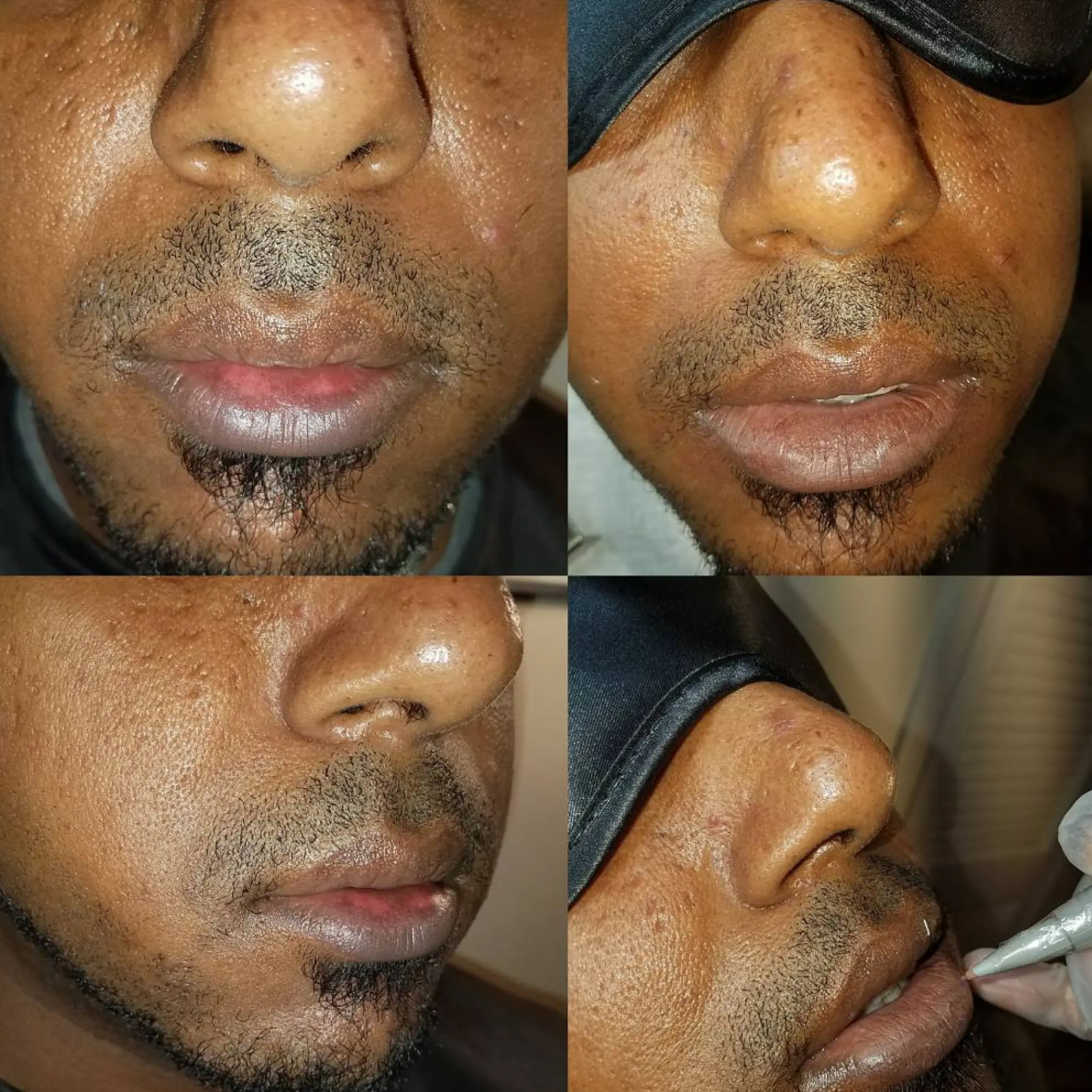 male lip tattoo healing stages images