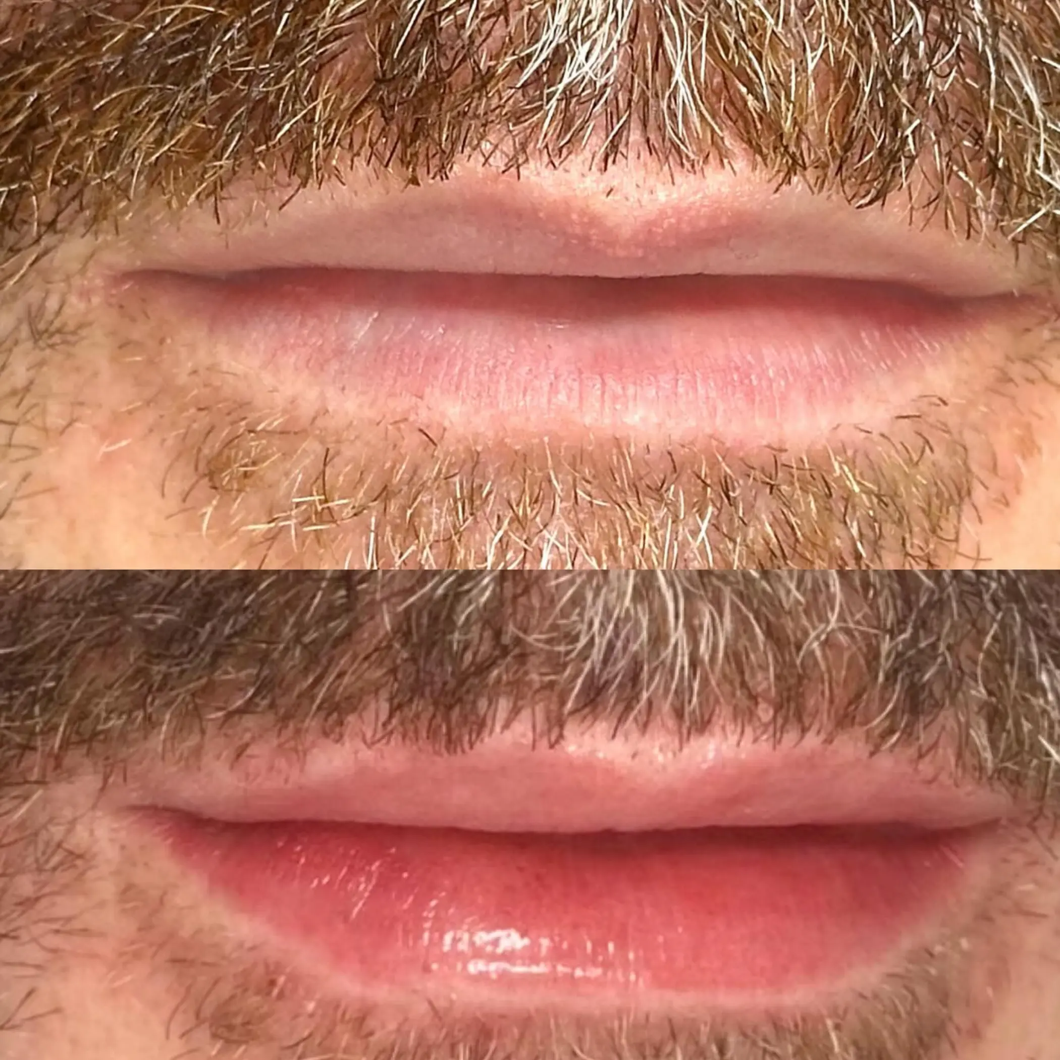men lip tattoo before after results