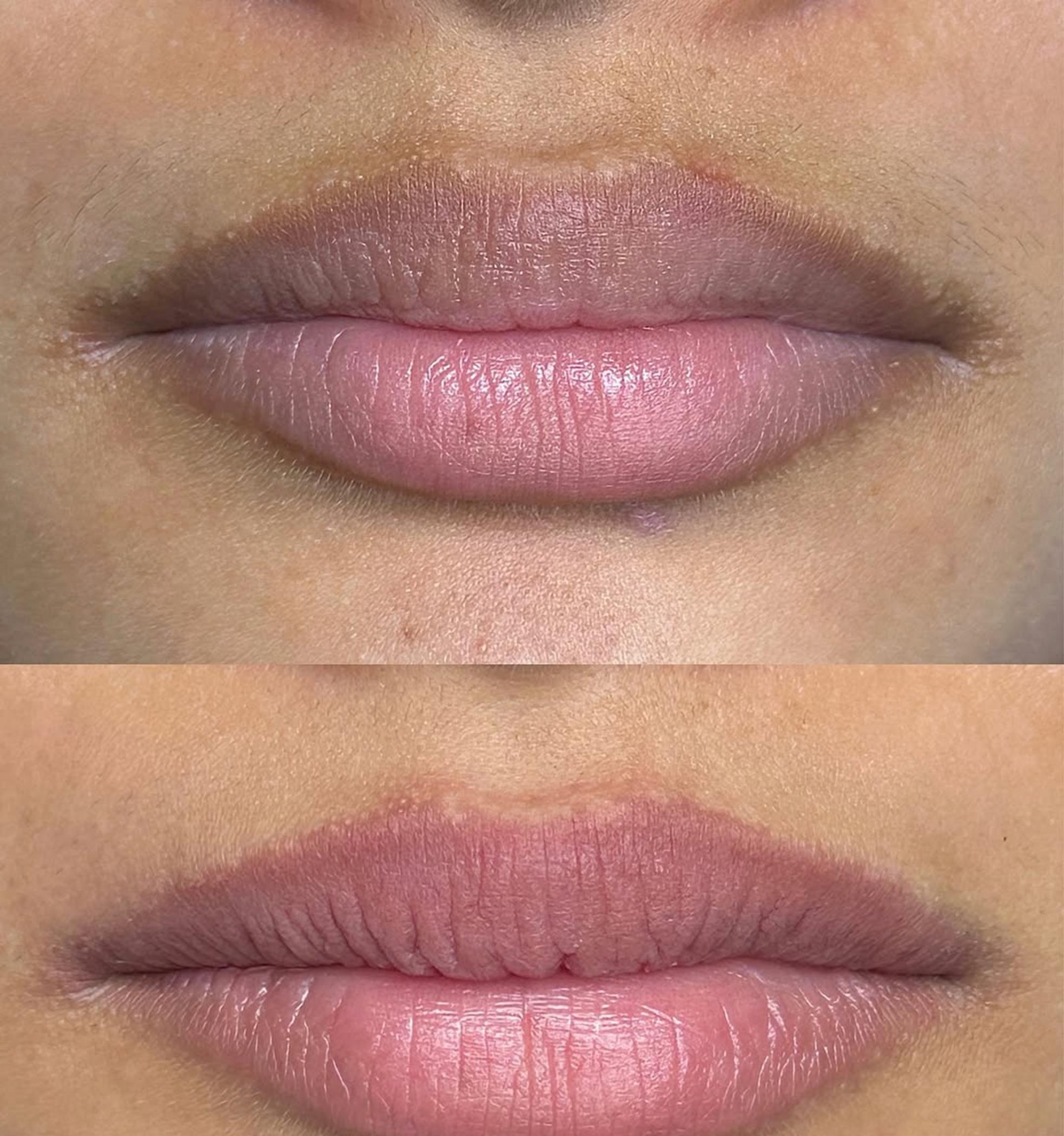 natural lip colour after permanent makeup