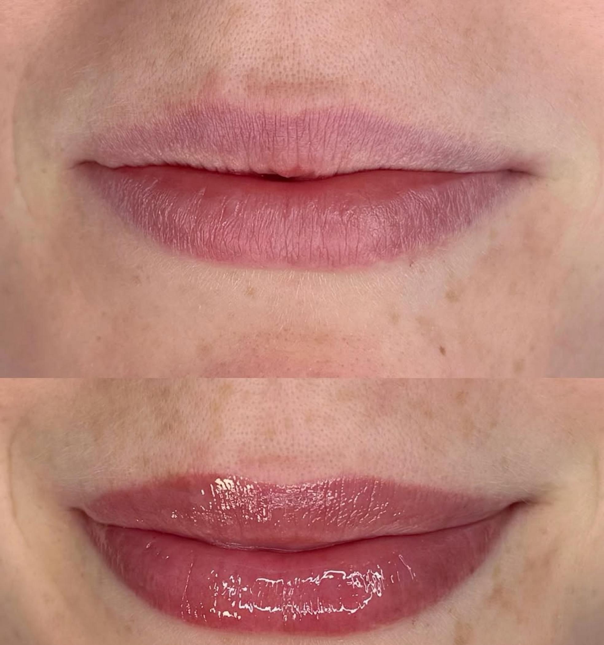 natural toned lips after tattoo
