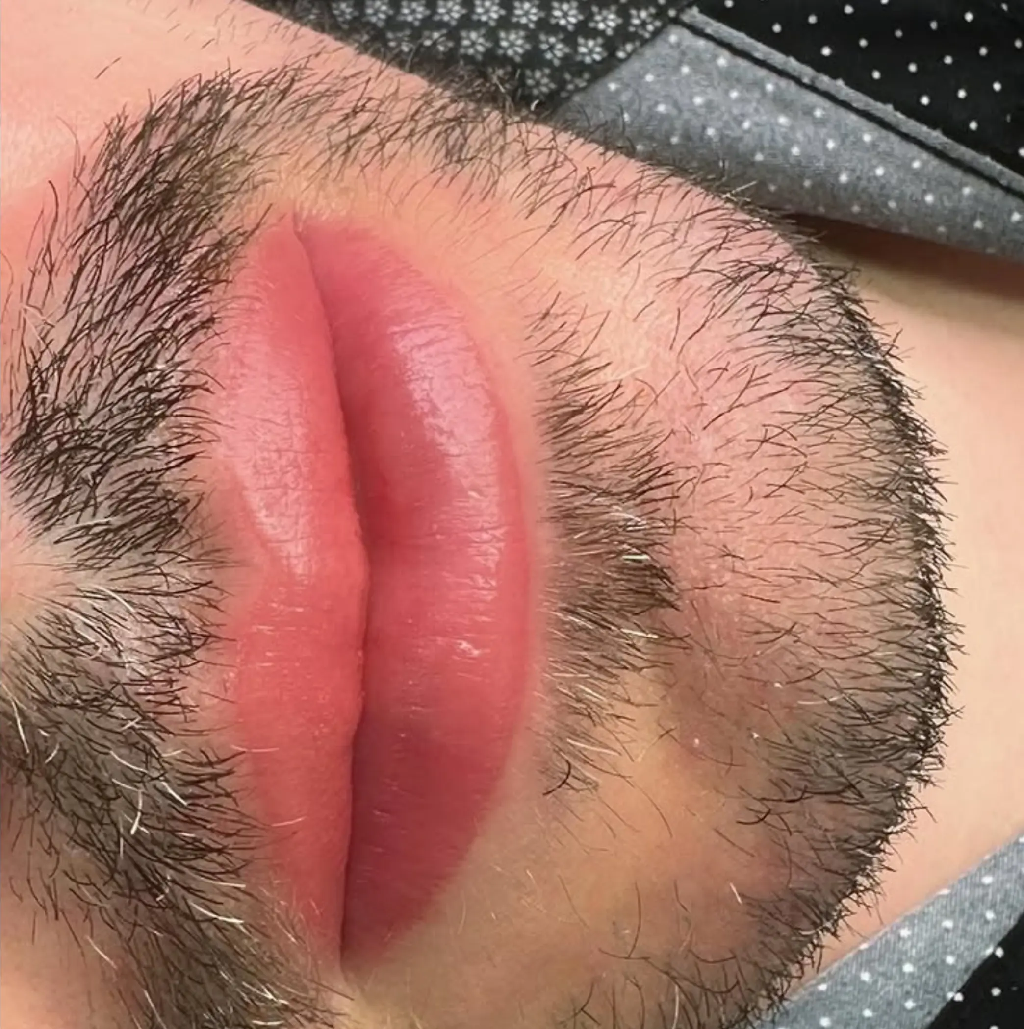 scalp micropigmentation healing stages photos