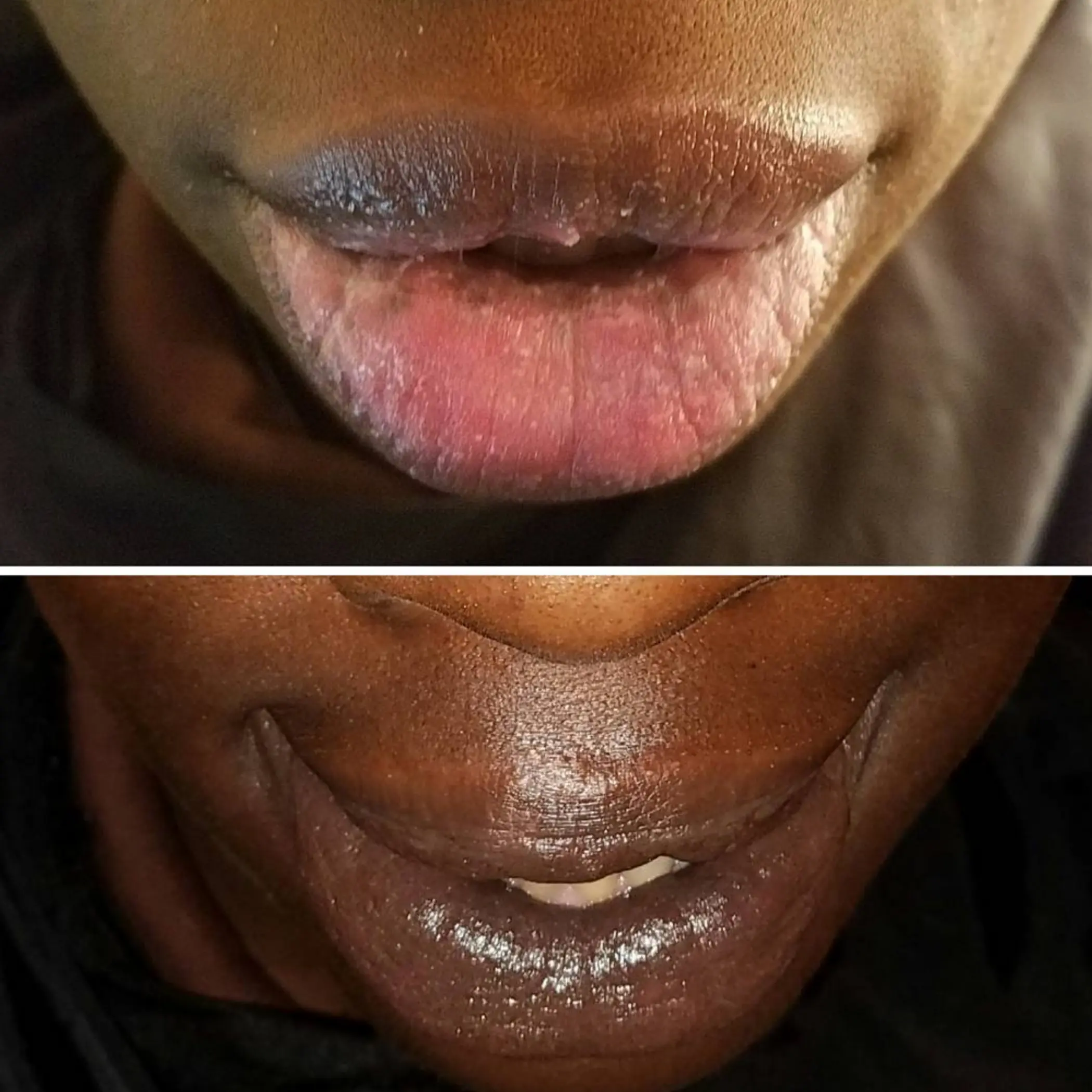 stages of lip tattoo healing close view