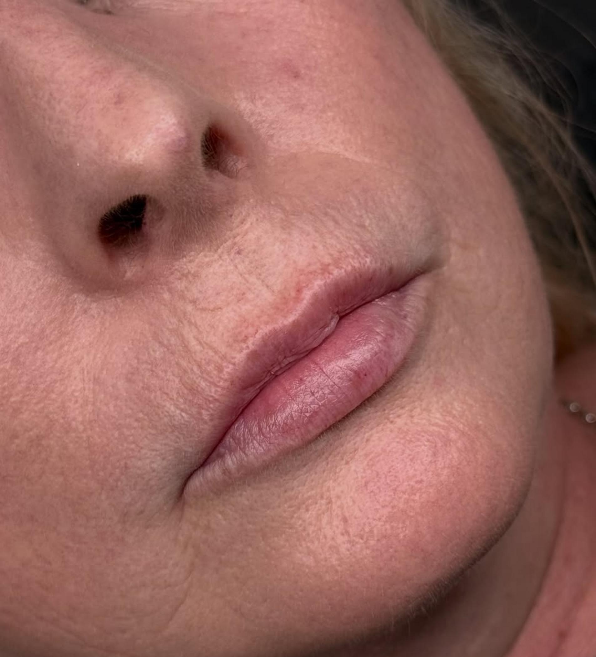 technician applying lip balm powder