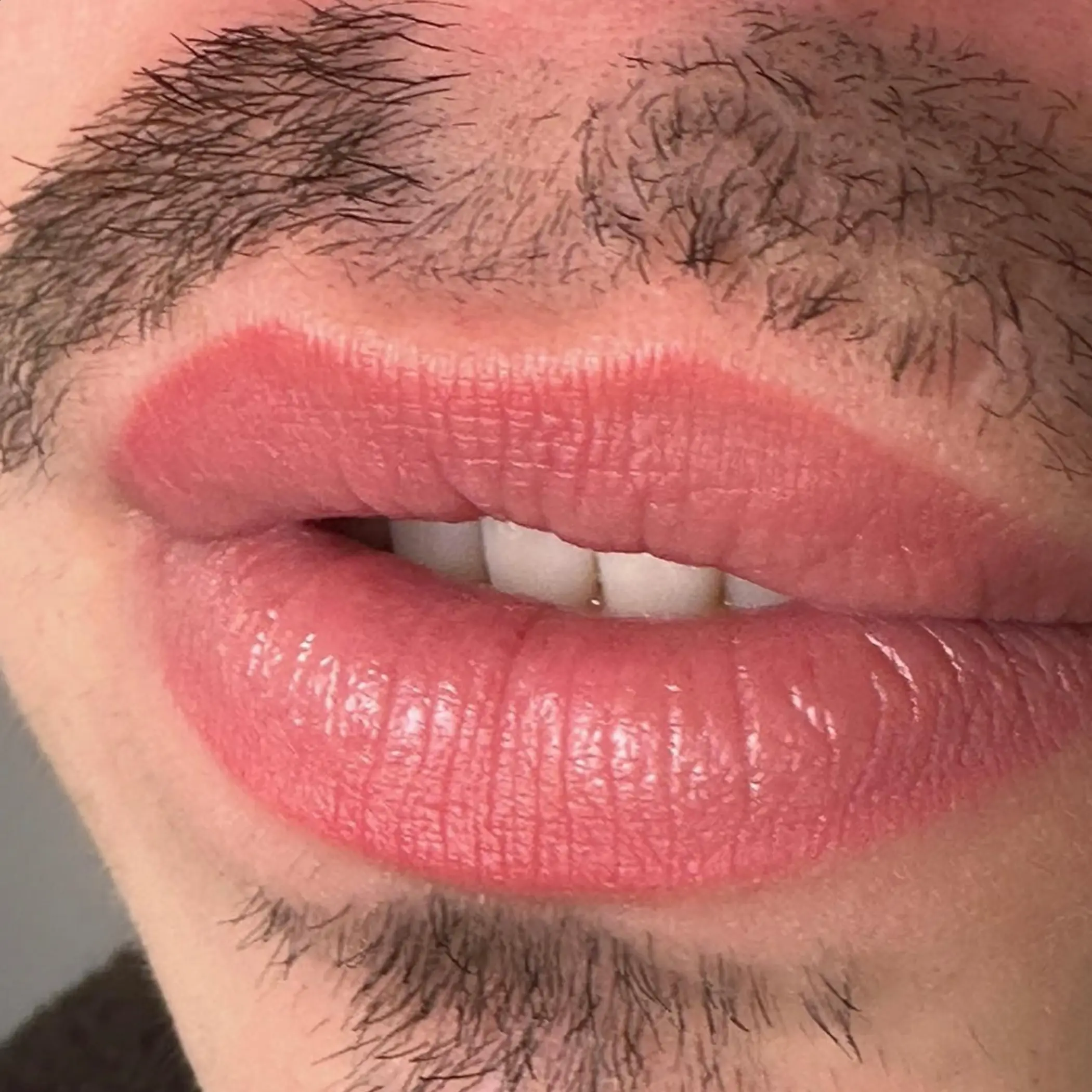technician performing lip blush procedure