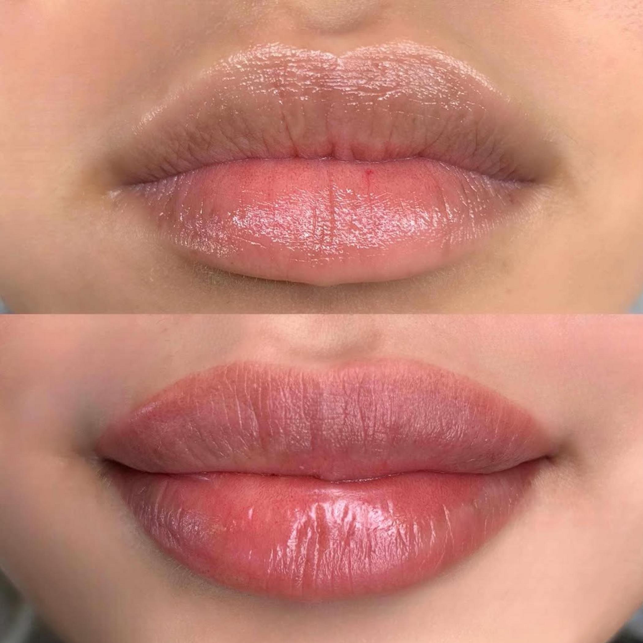 technician shaping lips with precision